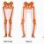 Nogi na kółkach: przyczyny i leczenie u dorosłych i dzieci. Co zrobić, jeśli dziewczyna ma nogi na kółkach